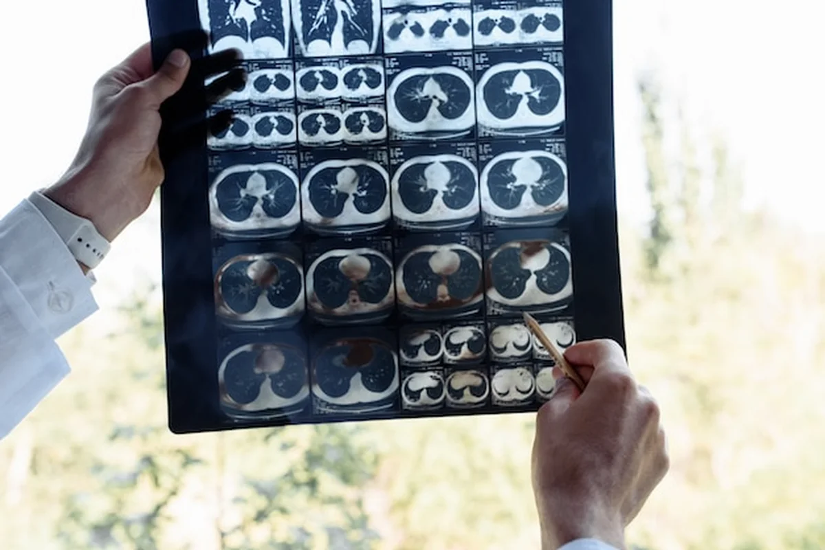 Lekarz bada zdjęcie rentgenowskie na białym tle