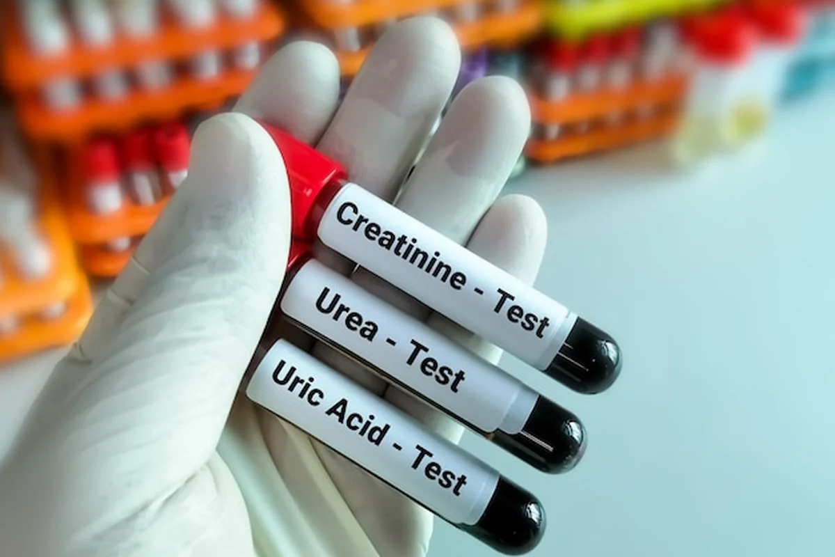 Probówki na próbki krwi do badania funkcji nerek